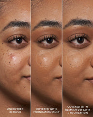 Blemish Defeat'r BHA Spot-Targeting Gel