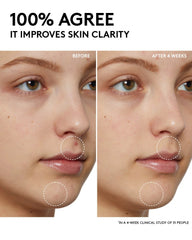 Fenty Skin Start’rs Full-Size Bundle with Mineral SPF: Oily Skin Edition