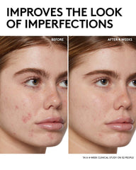 Fenty Skin Start’rs Full-Size Bundle with Mineral SPF: Oily Skin Edition